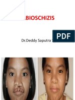 Labioplasty