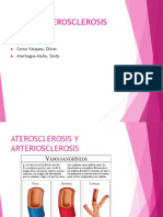 Aterosclerosis Expo Dilcer