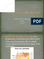 basalcellcarcinoma-161119170908