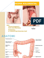 Karsinoma Kolorektal