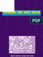 TUMORA de SAC YOLK - Imagini Histo.doc