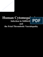 Human Cytomegalovirus: Infection in Stillbirths and The Fetal Thrombotic Vasculopathy