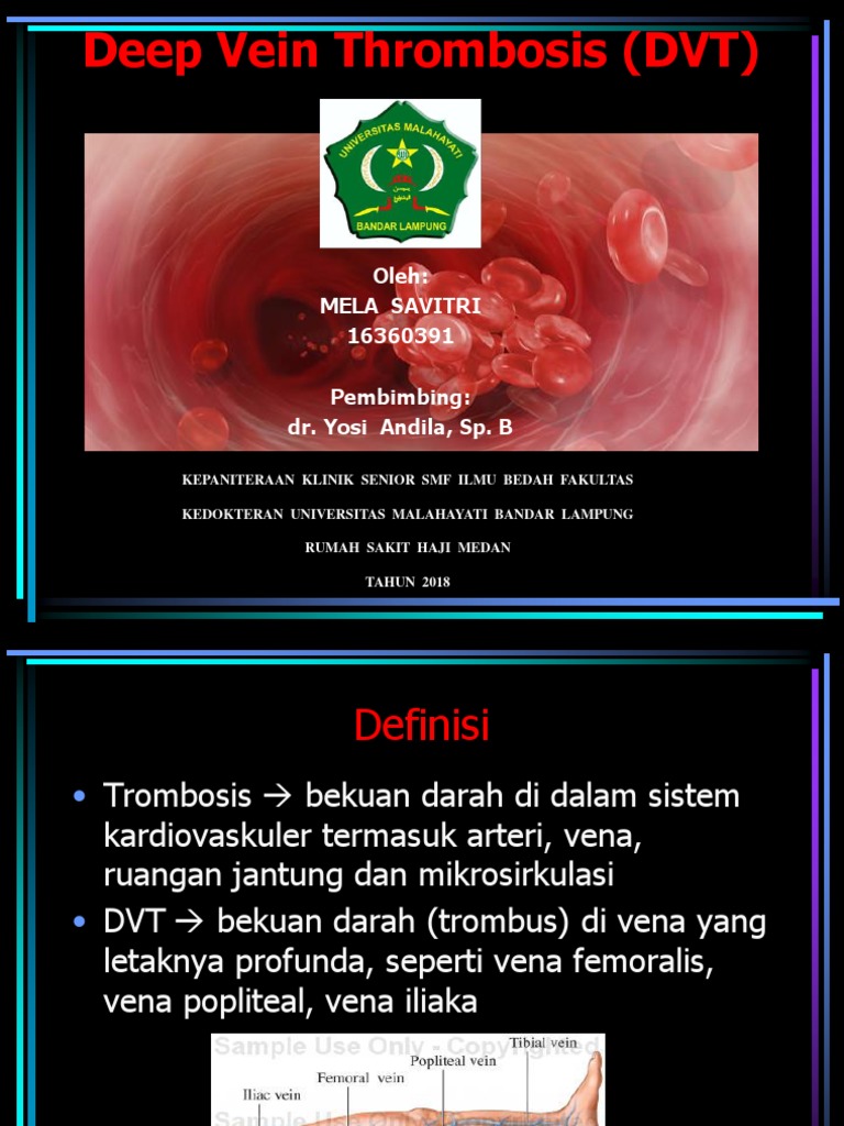Panduan Lengkap Deep Vein Thrombosis | PDF
