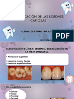 Clasificación de Las Cavidades