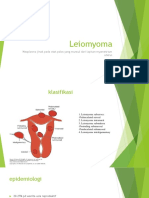 Leiomyoma