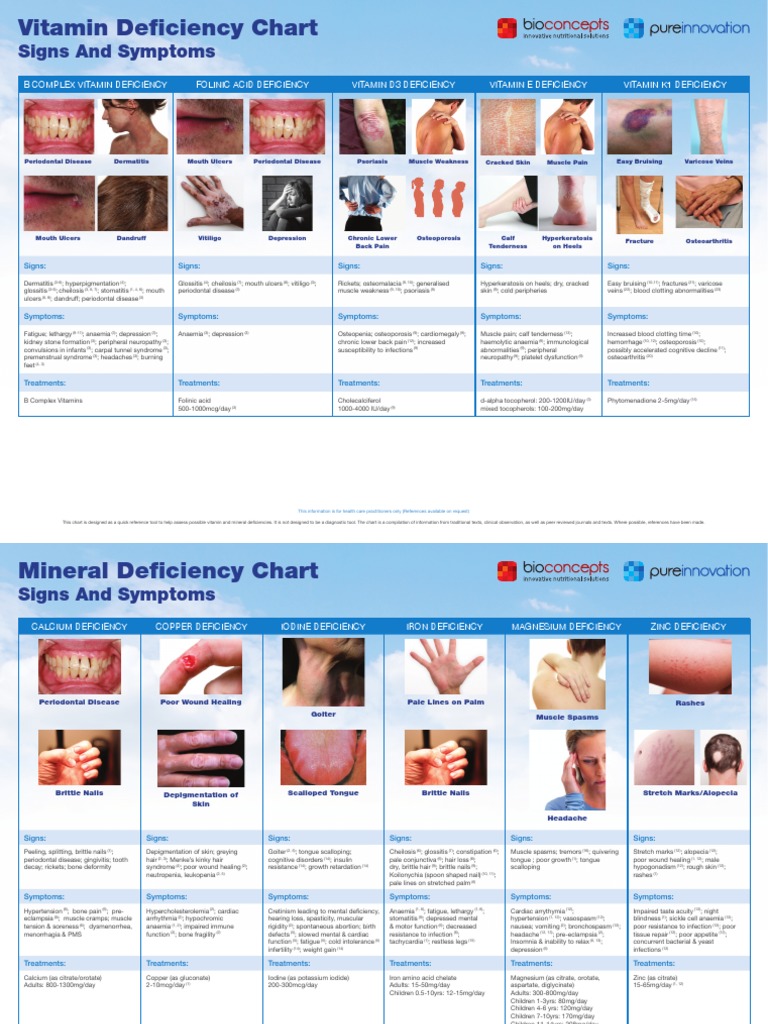 Vitamin Deficiency Chart: Signs and Symptoms | PDF | Anemia | Osteoporosis