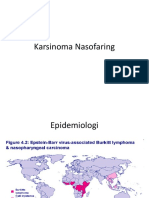 Karsinoma+Nasofaring