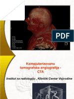 Idjuski Kompjuterizovano Tomografska Angiografija - CTA