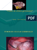 Tumor de Celulas Germinales