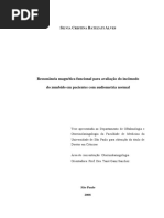 RESSONÂNCIA MAGNÉTICA FUNCIONALPARA AVALIAÇÃO DE INCÔMODO DE ZUMIDO EM PACIENTES COM AUDIOMETRIA NORMAL