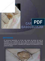 Carcinomabasocelular 150922094927 Lva1 App6891