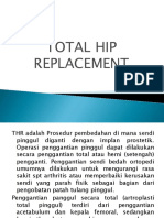 Total Hip Replacement