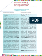 Distalización de Molares Con Aparato de Péndulo Modificado en Una Maloclusión Clase II Con Posición Ectópica de Canino PDF