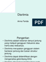 Disritmia Ii (Anna)