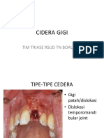 3. CIDERA GIGI-converted.pdf