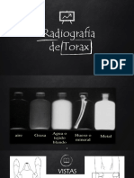 Radiografia de Torax