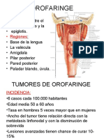 Tumores de Orofaringe