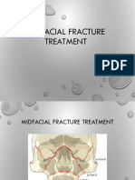 Midfacial Fracture Treatment