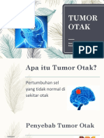 Tumor Otak: Gejala, Penyebab, Diagnosis dan Pengobatan