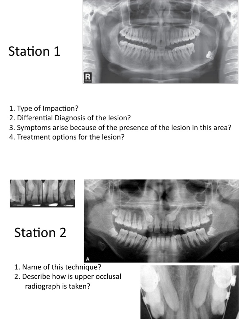 Oral Surgery Exam Questions and Answers | PDF | Differential Diagnosis ...