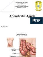 Apendicitis Aguda