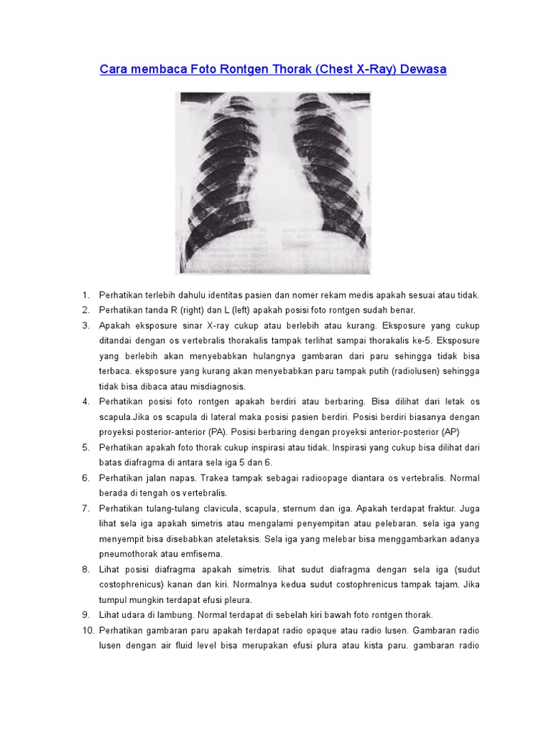 Cara Membaca Rontgen Thorax Dewasa | PDF