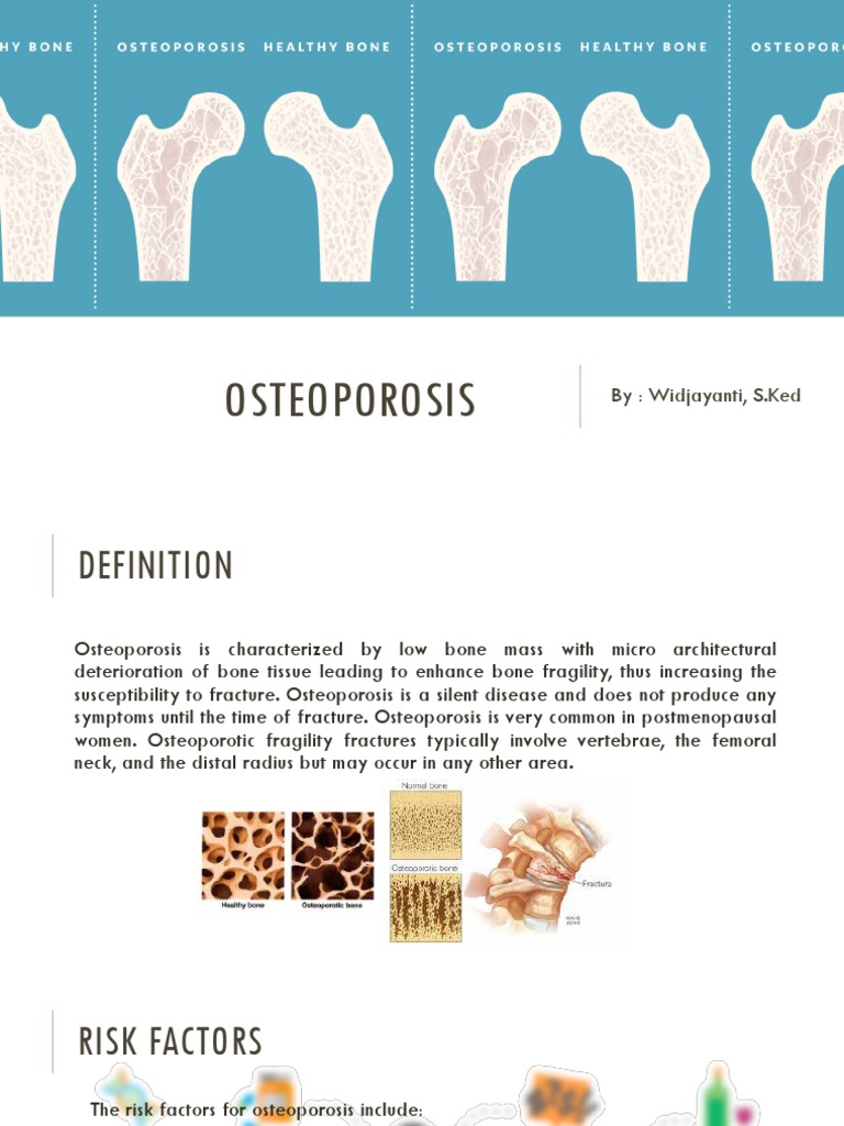 The Management of Osteoporosis | PDF | Osteoporosis | Bone