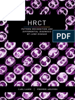 HRCT Pattern Recognition and Differential Diagnosis of Lung Disease