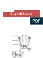 B Lynch Suture