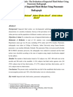 2.tahrir N. Aldelaimi Article The Evaluation of Impacted Third Molars Using Panoramic Radiograph