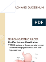 Stomach and Duodenal Ulcer Classification and Treatment