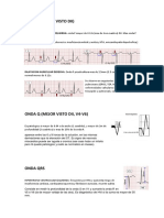 Ecg Rapido