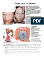 Tipos de Intoxicacion Alimentarias