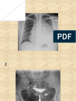 Soal Radiologi.pptx