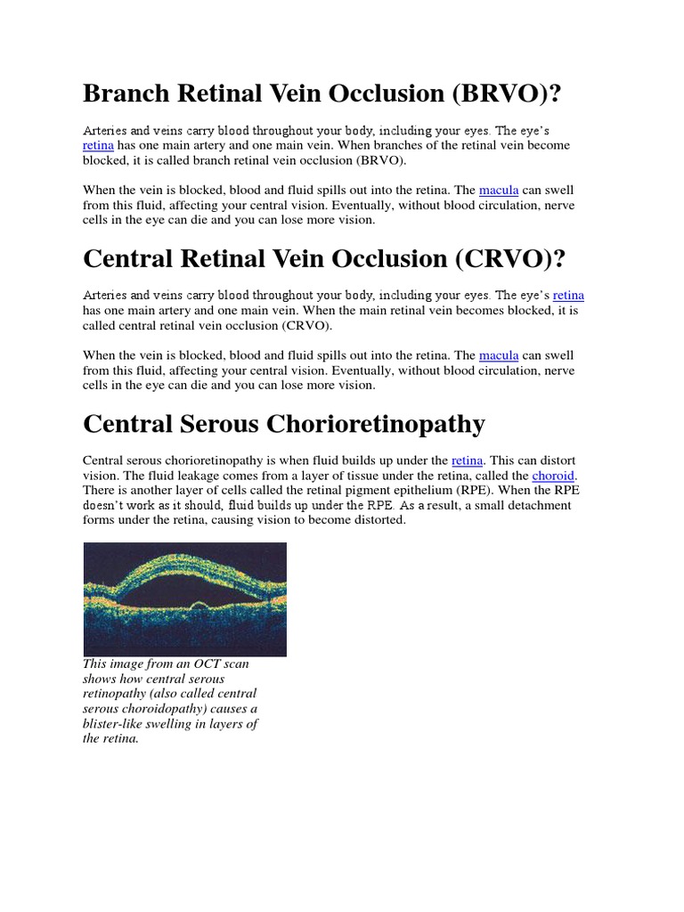 Branch Retinal Vein Occlusion | PDF | Retina | Visual System