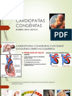 Cardiopatías Congénitas: Nombre: Erick Orozco