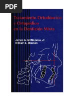 Ortodoncia Denticion Mixta