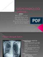 Tugas Radiologi Kasus Jantung Rika