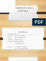 GAMBARAN-EKG-ARITMIA.pptx