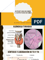 Hipertiroidismo