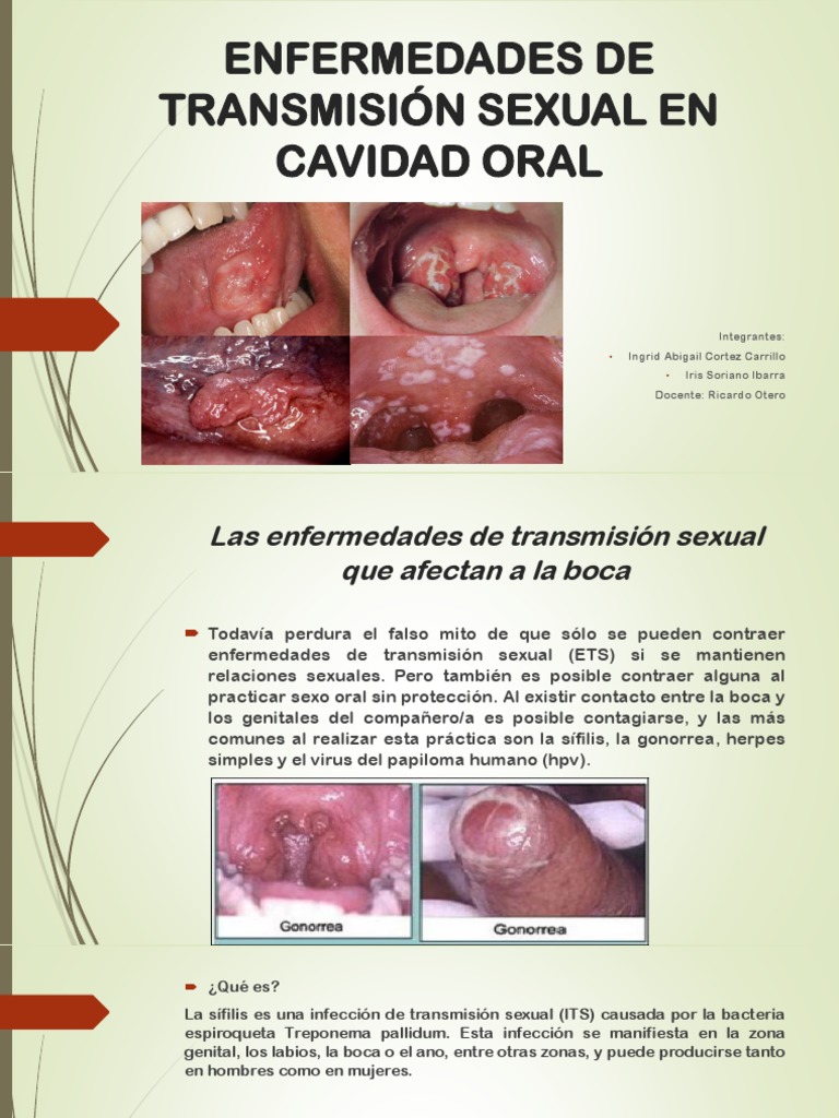 INFECCIONES DE TRANSMISION SEXUAL EN LA BOCA_2