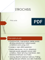 GASTROSCHISIS PADA BAYI