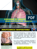 Síndrome insuficiencia respiratoria adulto (SIRA