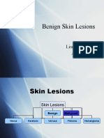 Benign Skin Lesions Types and Characteristics