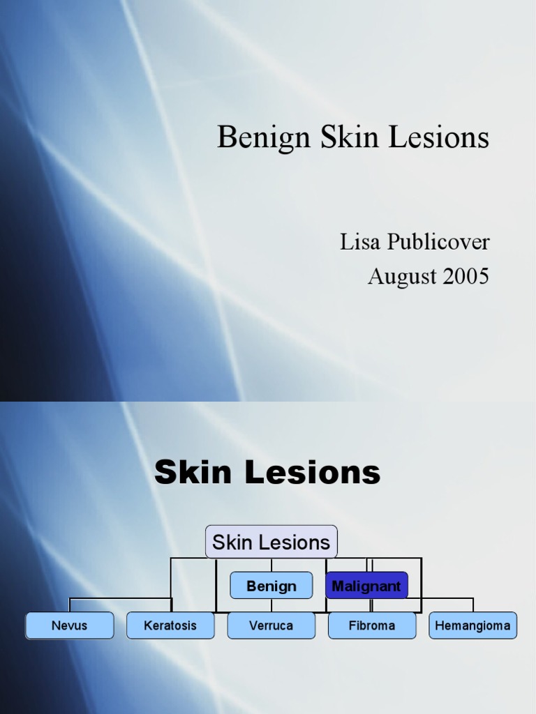 Overview of Benign Skin Lesions | PDF | Neoplasms | Skin