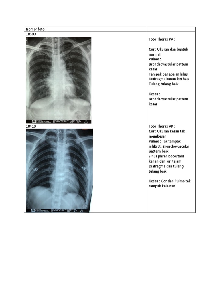 Radiologi | PDF