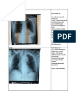 radiologi 