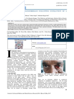 Case Report: Subconjunctival Haemorrhage Following Extraction of A Tooth