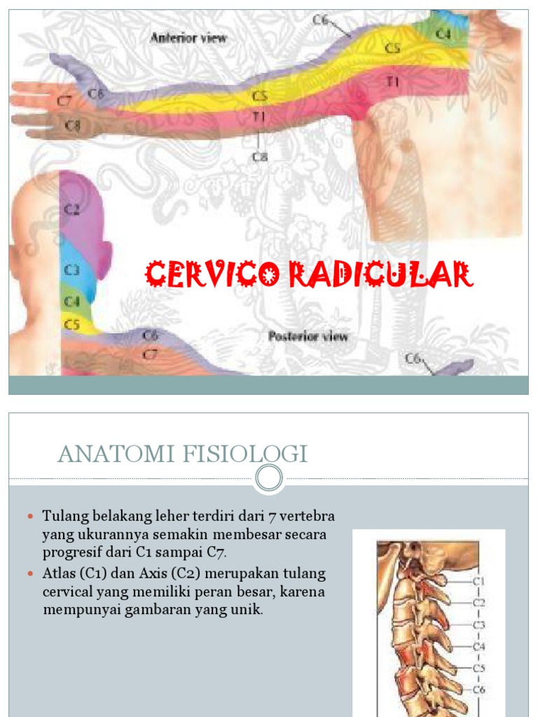 Radikulopati | PDF