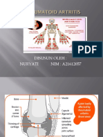 Rheumatoid Artritis